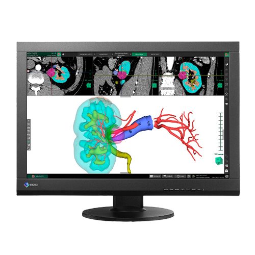 Eizo – Micro Comercio